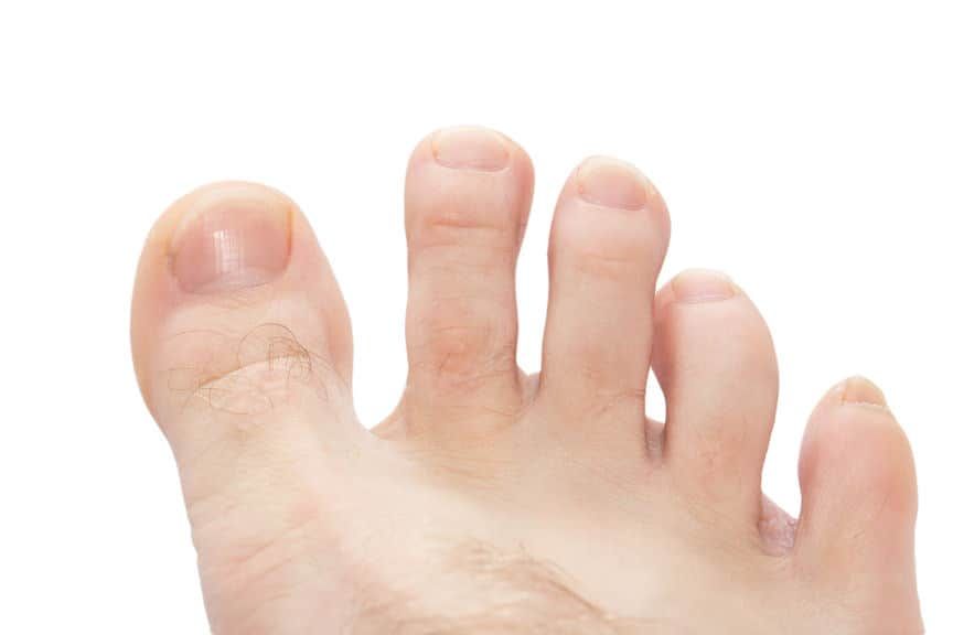 toes on a white background. macro